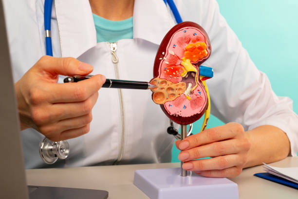 7 Common Signs of Kidney Stones You Should Never Ignore
